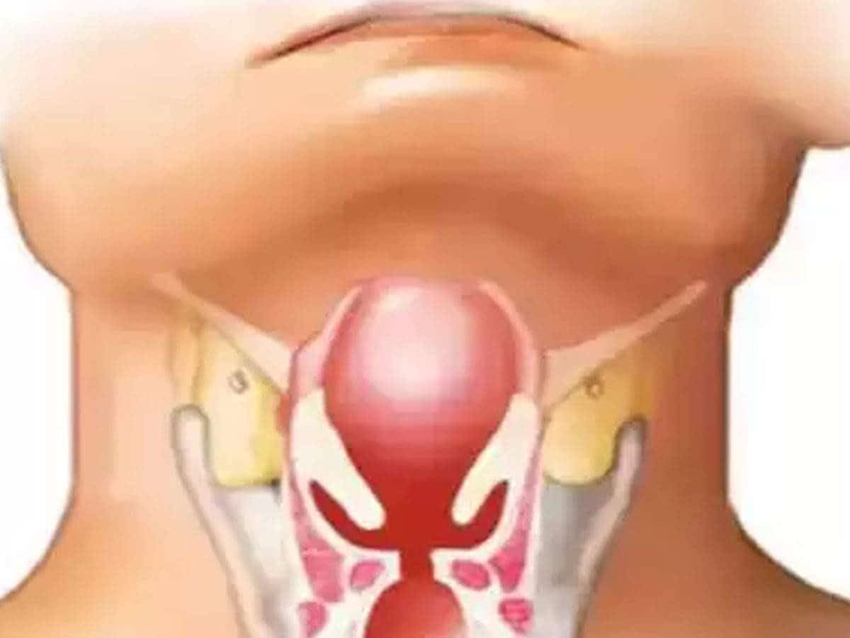 ظهور حالات مرض “دفتيريا” في الزبداني