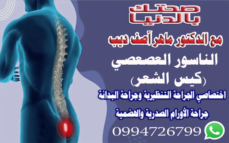 الناسور العصعصي (كيس الشعر)